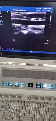 PH L12-5 Medizinische Diagnose Ultraschalllineare Sondenwandler für PH HD9 Kompatibel